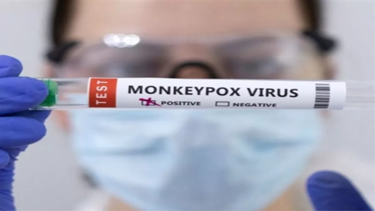 Monkeypox Test Kit in India: देश में मंकीपाक्‍स का कोई केस नहीं लेकिन तैयारियां पुख्‍ता, ट्रिविट्रान हेल्थकेयर ने विकसित की जांच किट