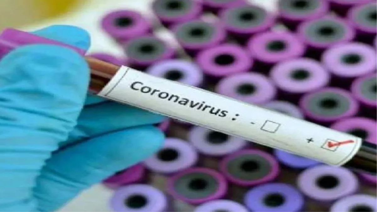 Bhagalpur covid 19 : आज फ‍िर कोरोना वायरस से 10 लोग संक्रमित, डाक्‍टर का भी हो रहा है इलाज