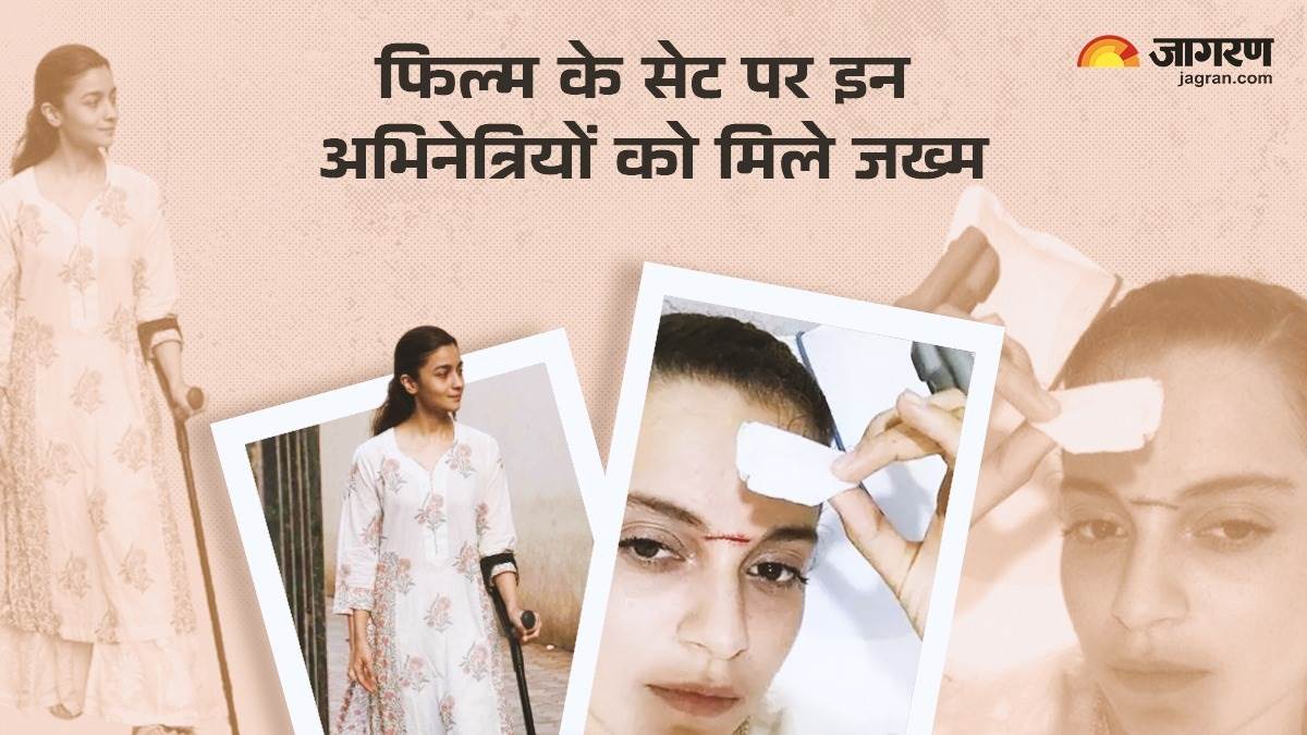 https://www.jagranimages.com/images/newimg/27062024/27_06_2024-bollywood_actresses_injured_on_set_23747634_191553764.jpg