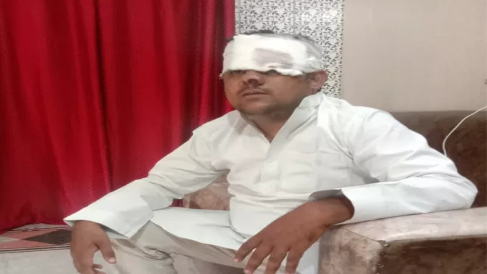 कांवड़ियों की सेवा करने वाले मुस्लिम युवक पर जानलेवा हमला