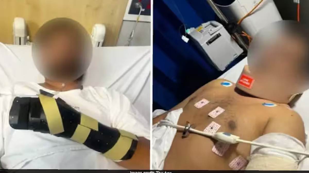 https://www.jagranimages.com/images/newimg/27072025/27_07_2025-australia_indian_attacked_23995574.jpg