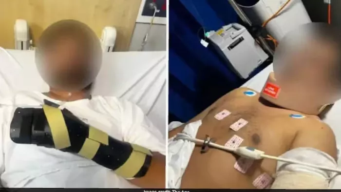 ऑस्ट्रेलिया में हमले के बाद अस्पताल में भर्ती सौरभ आनंद। फोटो- सोशल मीडिया