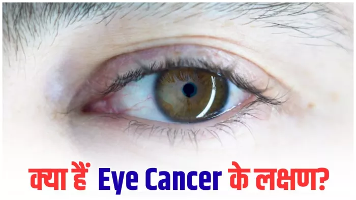 क्यों होता है आंखों में कैंसर (Image Credit- Freepik)