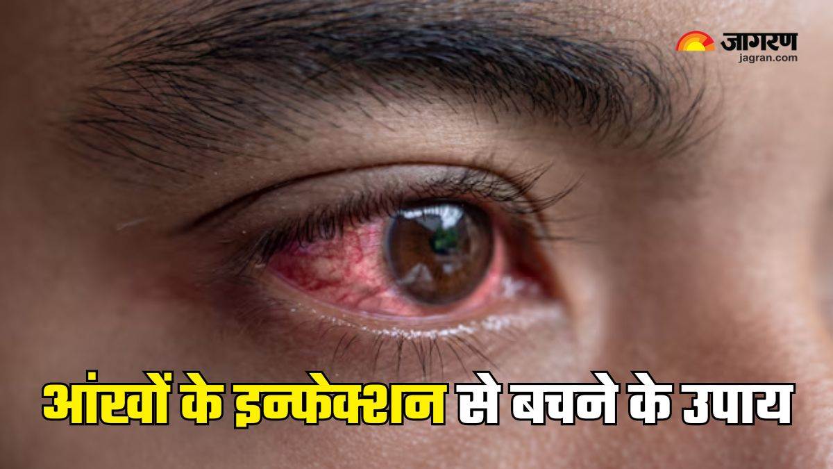 https://www.jagranimages.com/images/newimg/27082024/27_08_2024-eye_infection_in_monsoon_23786018.jpg