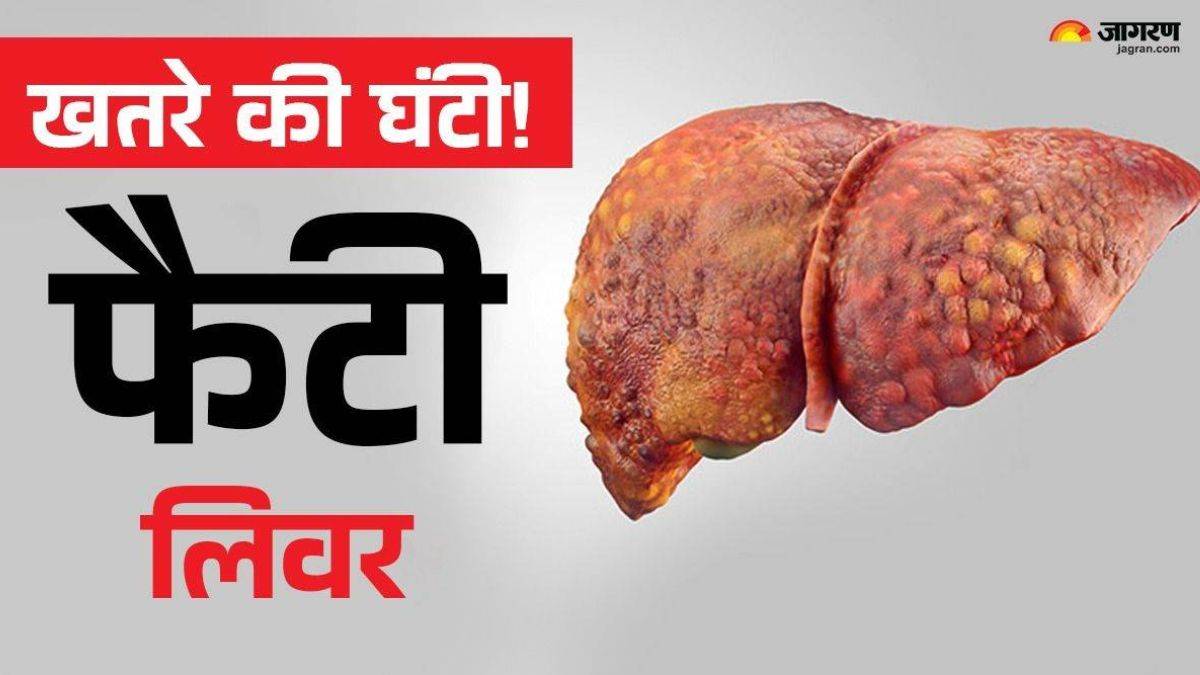 https://www.jagranimages.com/images/newimg/27082025/27_08_2025-fatty-liver_24026922_17133623.jpg