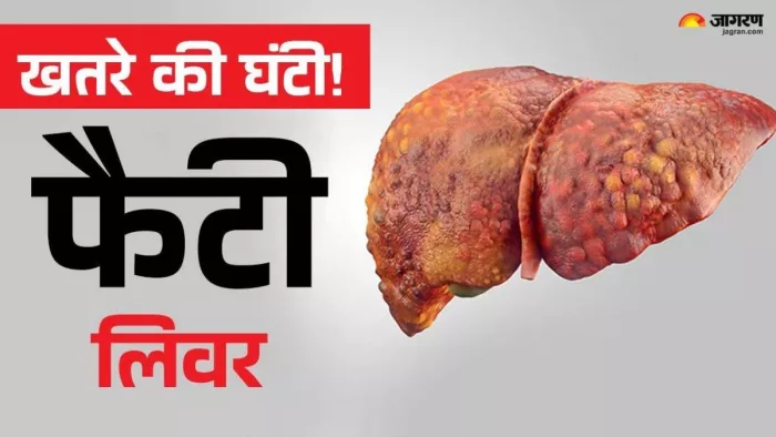 फैटी लिवर स्किन में दिखने वाले इन बदलावों को न करें अनदेखा (Picture Credit- Freepik)