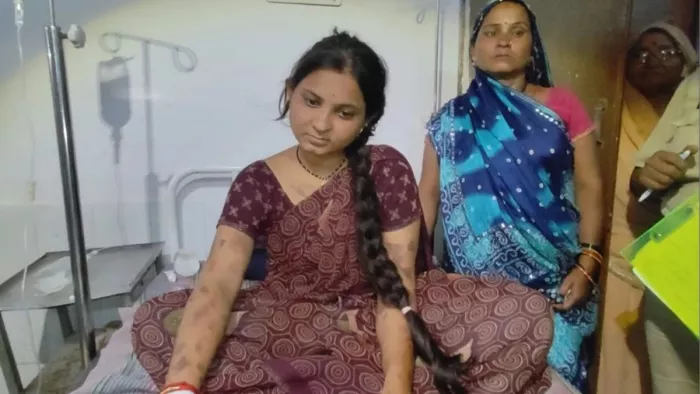 मध्य प्रदेश में दहेज के केस ने चौंकाया।