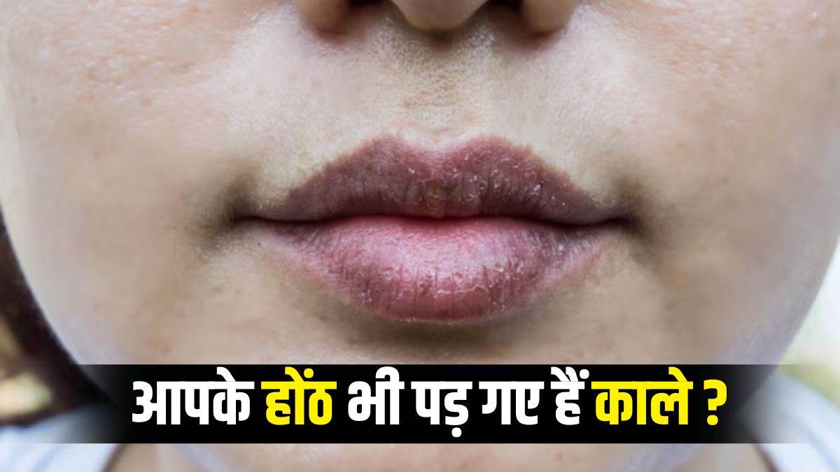 effective ways to lighten your dark lips follow these tips