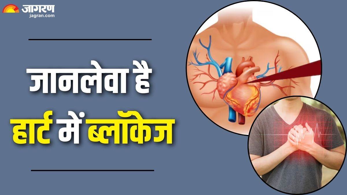 do not ignore blockage 5 serious symptoms to identify before a heart attack