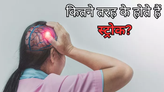 जानें क्या है स्ट्रोक, इसके प्रकार, कारण और लक्षण