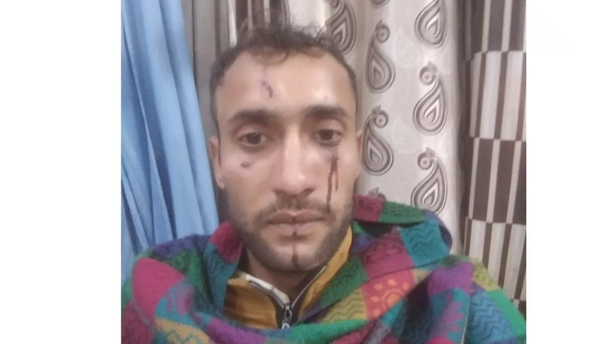 युवक पर हमला कर छीनी चांदी की चेन व नकदी