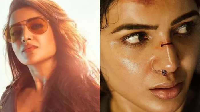 Samantha Ruth Prabhu: Samantha injured during the shooting of Citadel, shared photo in this condition