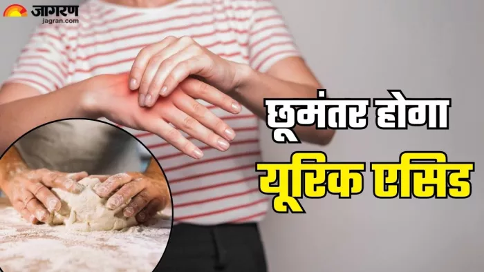यूरिक एसिड कम करने के लिए करें ये एक काम (Picture Credit- Freepik)