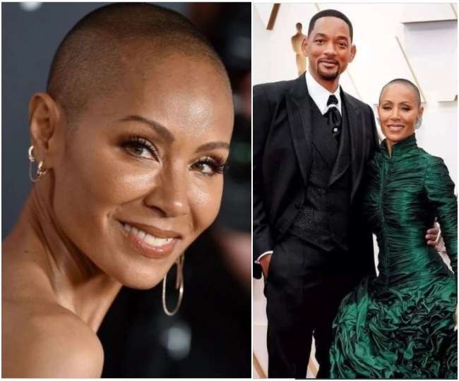 https://www.jagranimages.com/images/newimg/28032022/28_03_2022-alopecia-areata_22578218.jpg