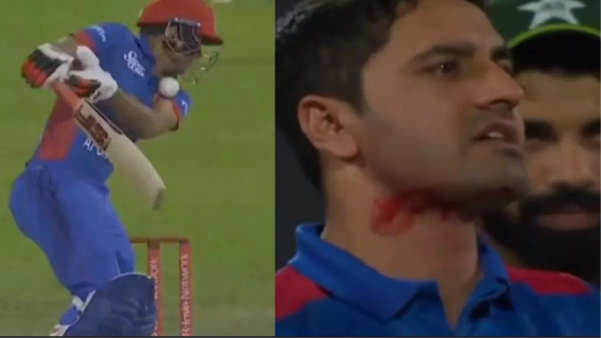 Najibullah Zadran injured by ihsanullah On Dangerous Bouncer VIDEO