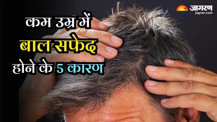 कम उम्र में ही सफेद हो गए हैं आपके बाल, तो ये हो सकते हैं इसके 5 कारण