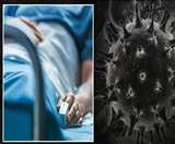 ब्लैक फंगस के मरीजों की संख्या हुई 43, चल रहा है इलाज।