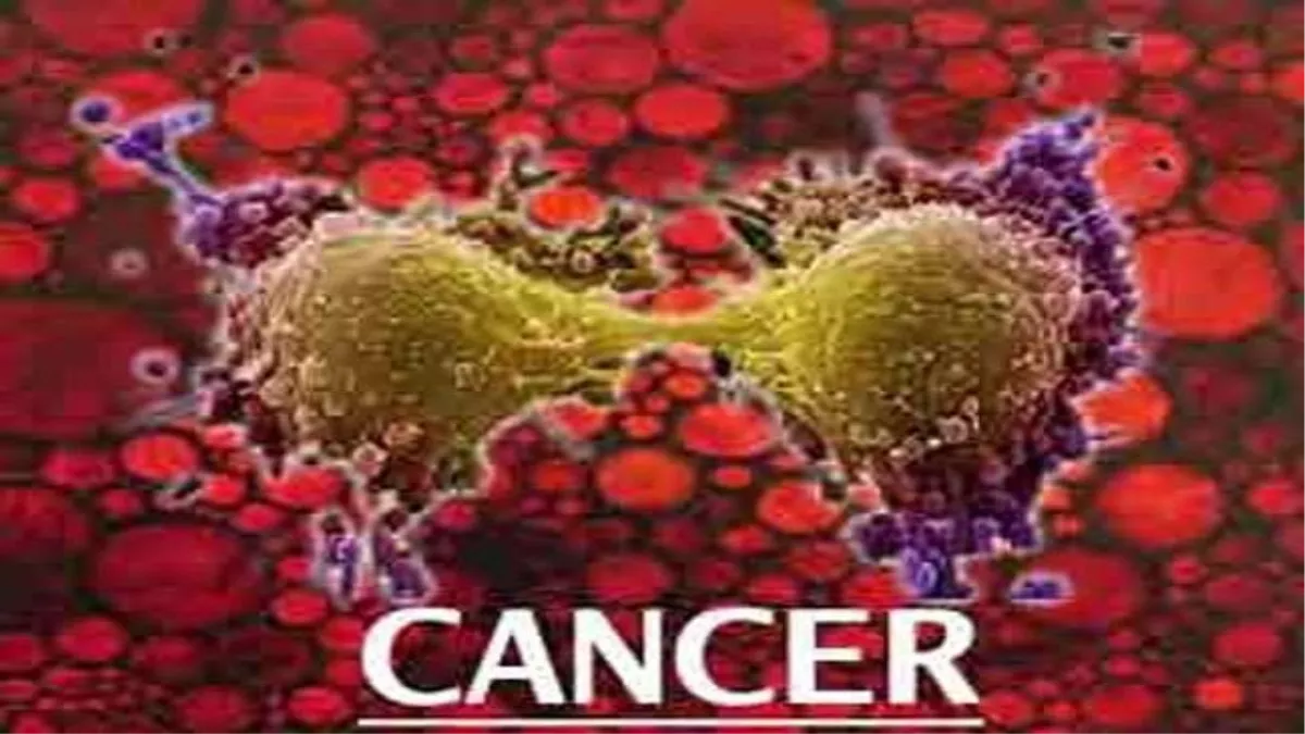 नैनो पार्टिकल से ब्रेन कैंसर का होगा इलाज, ट्यूमर बनने के मार्ग को बाधित करने वाले एक सूक्ष्म अणु की हुई पहचान