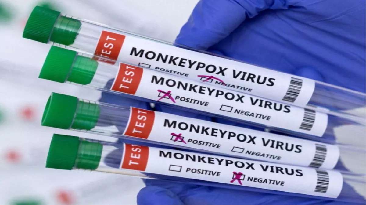 Monkeypox Alert: मंकीपॉक्स को लेकर आगरा में अलर्ट, पांच देशाें से आने वाले टूरिस्ट पर रखी जाएगी नजर, जानिए इस बीमारी के लक्षण