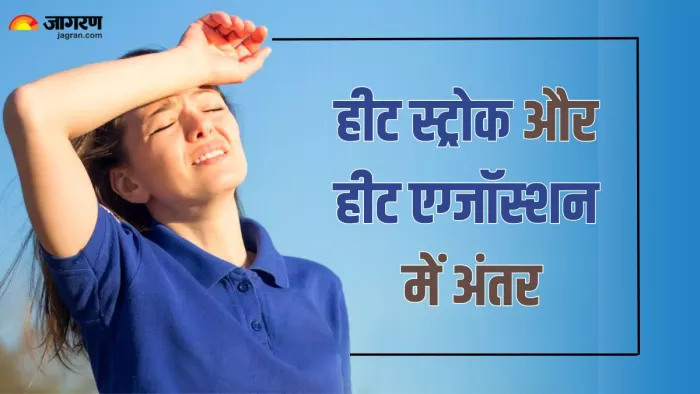 Heat Stroke vs Heat Exhaustion- जानें दोनों में अंतर (Picture Credit- Freepik)