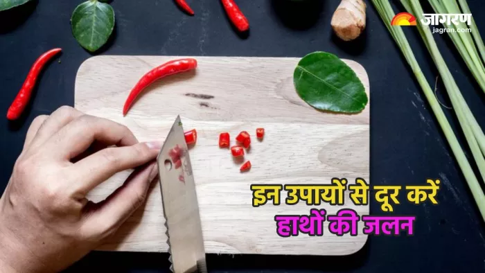 मिर्च काटने के बाद हाथों में होने वाली जलन दूर करने के उपाय (Pic credit- freepik)