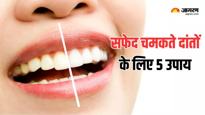 Teeth Whitening: दांतों का पीलापन दूर करने के लिए 5 घरेलू उपाय (Picture Courtesy: Freepik)