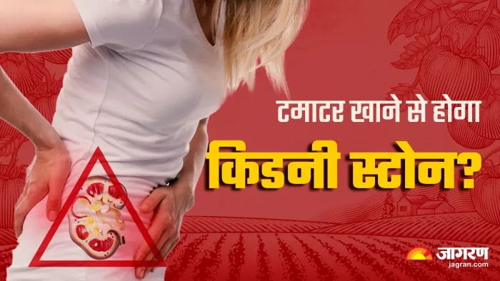 टमाटर खाने से किडनी स्टोन होता है या नहीं?
