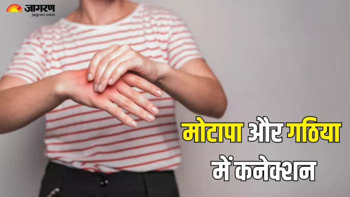 जानें मोटापा और आर्थराइटिस में कनेक्शन (Picture Credit- Freepik)