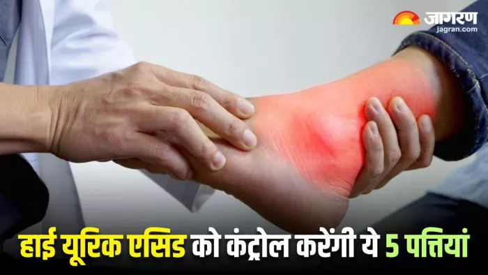 Uric Acid के बढ़े हुए स्तर को करना है कंट्रोल, तो शुरू कर दें इन पत्तियों का सेवन