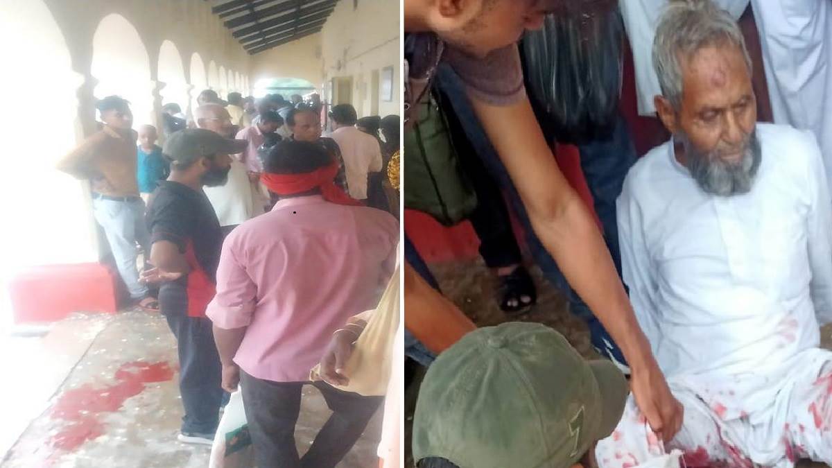 auraiya accident leg was amputated after being hit by a train at achhalda station