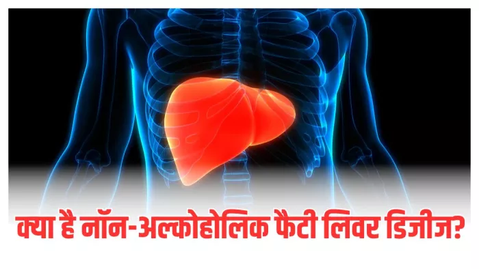 NAFLD के इन लक्षणों को न करें नजरअंदाज (Image Credit- Pexels)