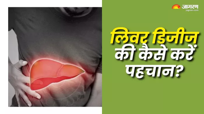 लिवर डिजीज के लक्षण कैसे होते हैं? (Picture Courtesy: Freepik)