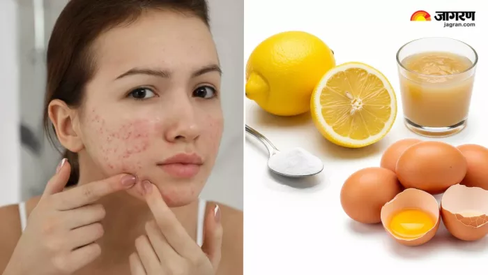 डर्मेटोलॉजिस्ट ने बताए स्किन पर न लगाने वाले 4 आइटम्स (Image Source: Freepik)