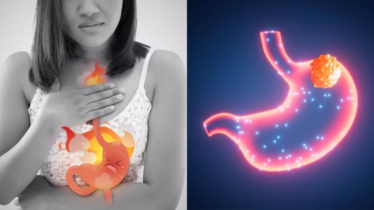 https://www.jagranimages.com/images/newimg/28082025/28_08_2025-stomach_cancer_symptoms_24028251.jpg