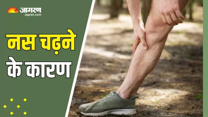 नस चढ़ने के पीछे हो सकती हैं ये वजहें (Picture Courtesy: Freepik)