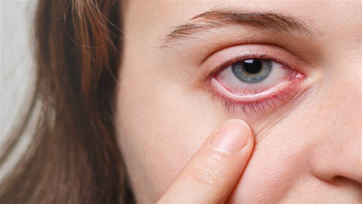 https://www.jagranimages.com/images/newimg/28092025/28_09_2025-eye_infection_freepik_24062878.jpg