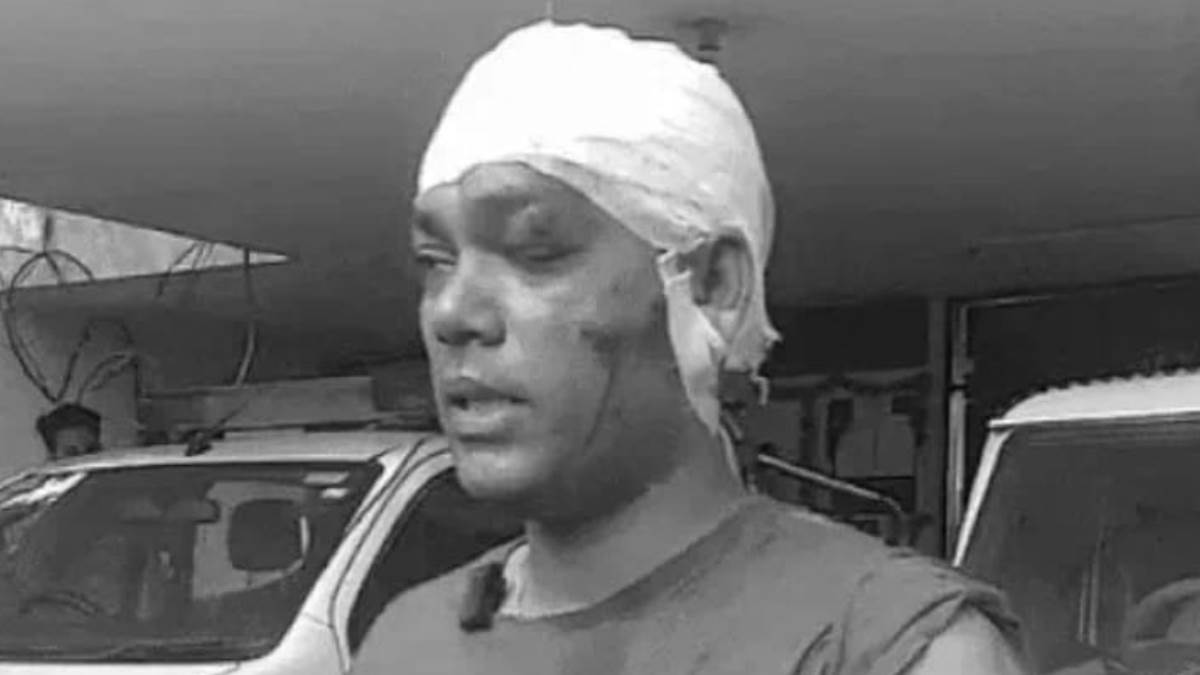accident outside former jalandhar minister kalias house newspaper distributor injured