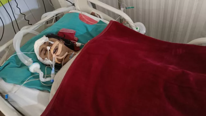 Ghaziabad: झपटमारों ने छात्रा से खींचा मोबाइल, असफल हुए तो ऑटो से खींचकर सड़क पर गिराया।
