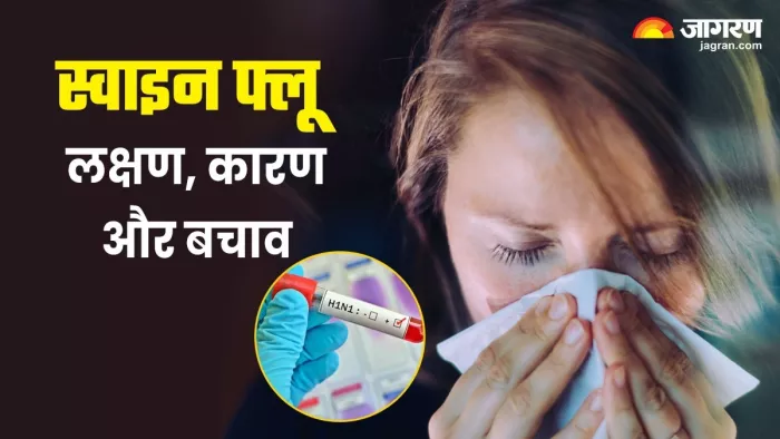 यूके में मिला स्वाइन फ्लू का नया स्ट्रेन, जानें इसके बारे में सबकुछ