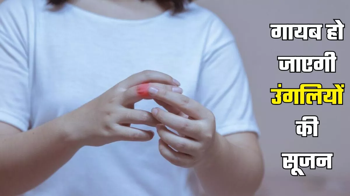 ठंड में हाथ-पैरों के उंगल‍ियों की सूजन को कम करेंगे ये Home Remedies
