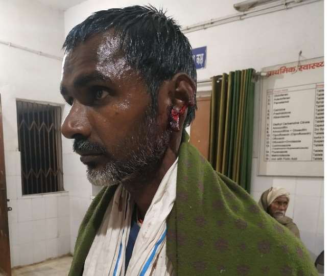 Bihar News : वोट नहीं देने पर काट लिया कान, चुनाव जीतने के बाद मुखिया मुटुरवा देवी के देवर ने दिखाया अपना पावर, पढ़िए पूरी खबर