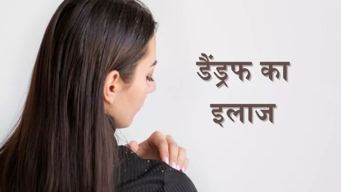 डैंड्रफ की समस्या दूर कर कर सकता है कपूर का तेल