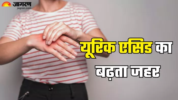 हाई यूरिक एसिड के अनदेखे संकेत (Picture Credit- Freepik)