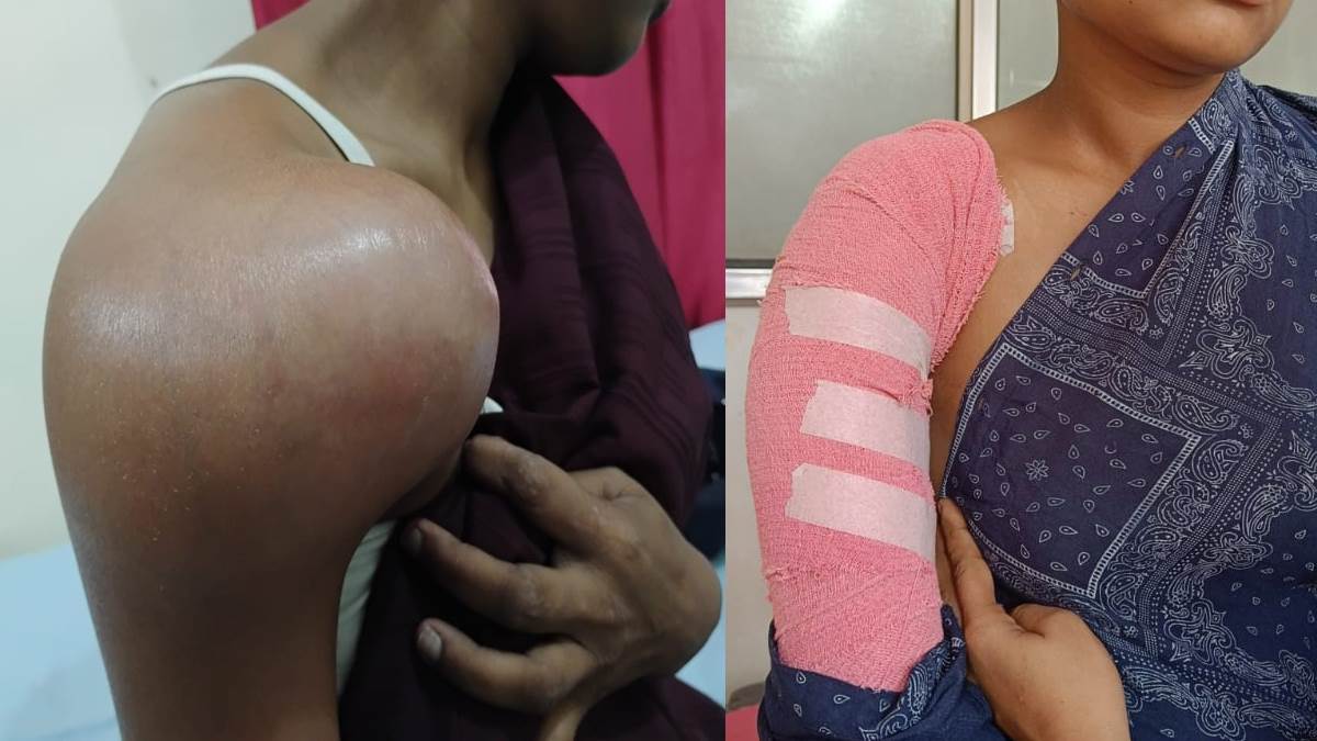 https://www.jagranimages.com/images/newimg/29052025/29_05_2025-surgery_23950408.jpg
