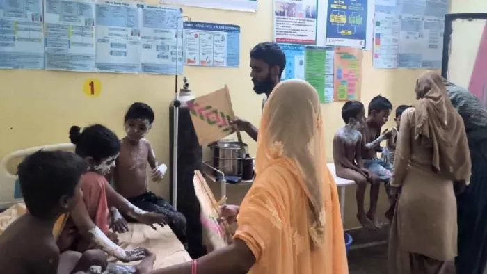 नौगढ़ सामुदायिक स्वास्थ्य केंद्र में आग से झुलसे बच्चों को किया जा रहा उपचार। जागरण।