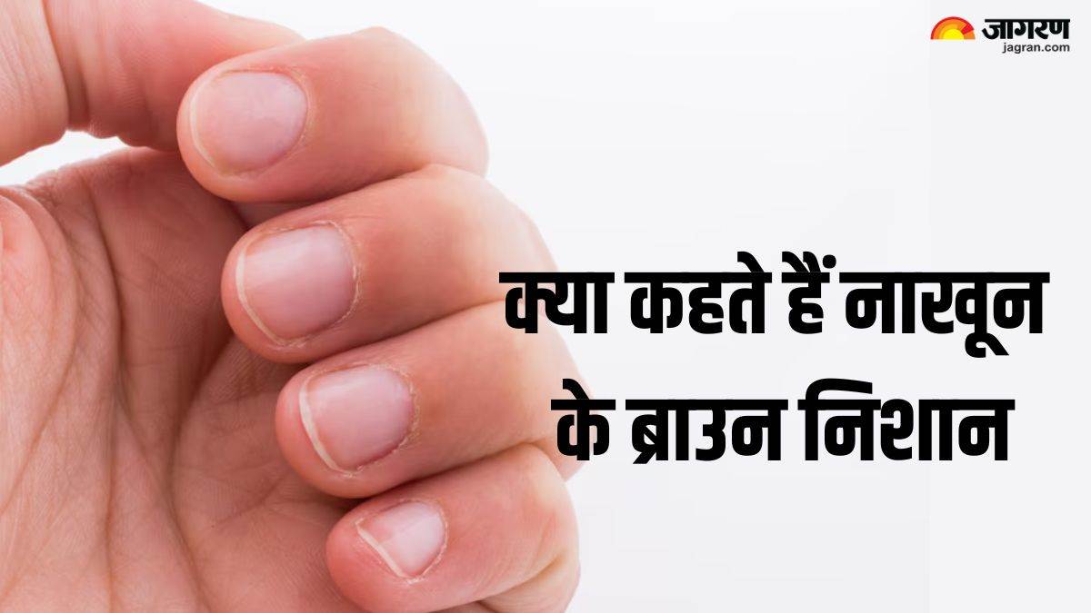 brown spots or lines in nails may be sign of many health issues