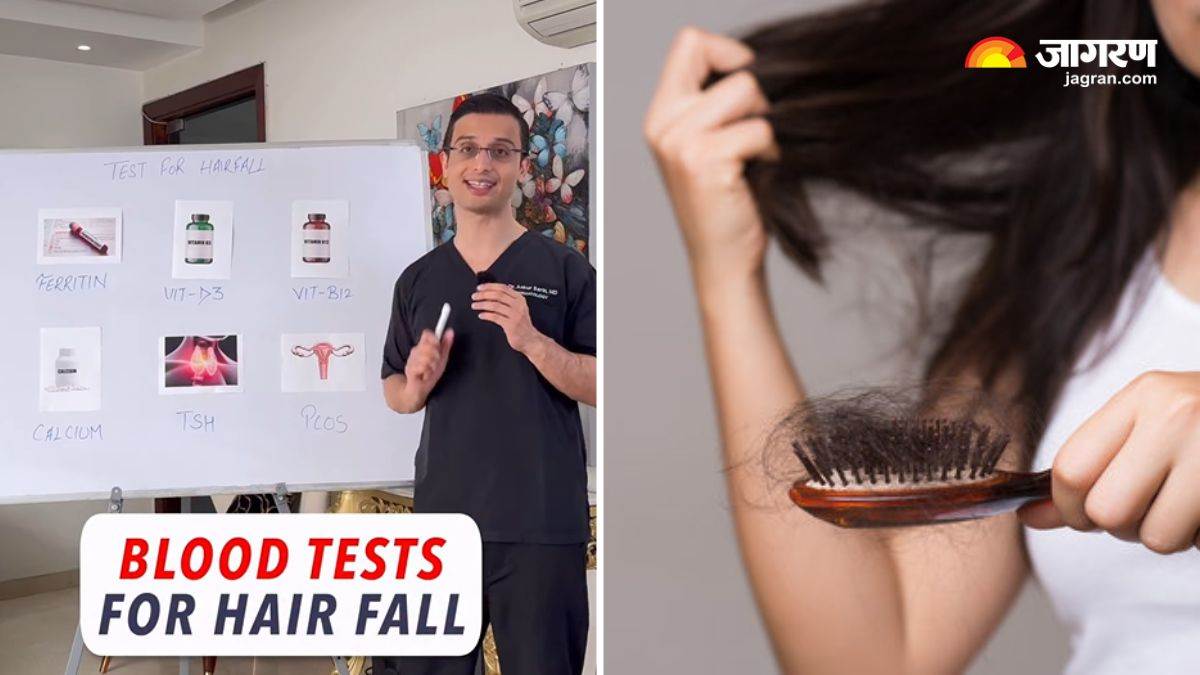 if you are troubled by hair fall then definitely get these 6 blood tests done special advice from a dermatologist