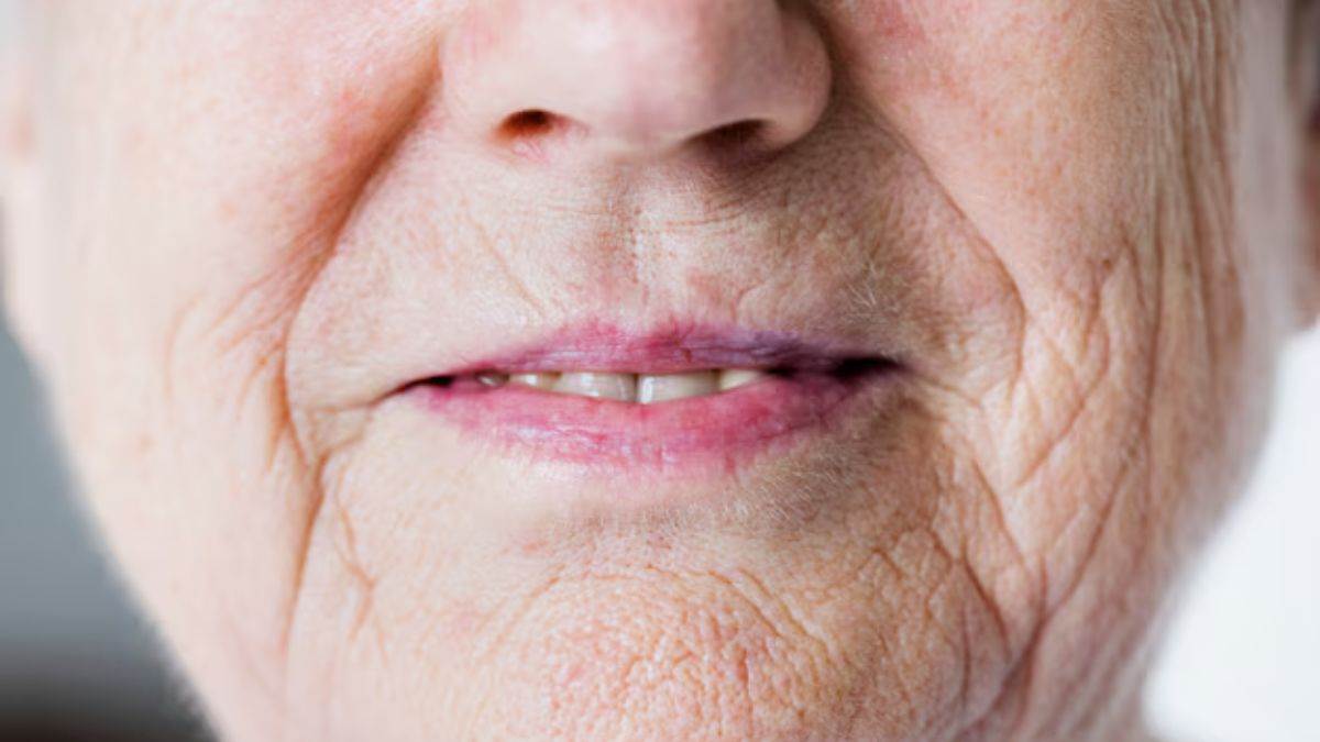 https://www.jagranimages.com/images/newimg/29062025/29_06_2025-premature_wrinkles_23970183.jpg