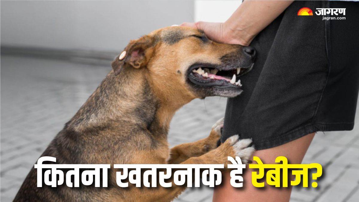 https://www.jagranimages.com/images/newimg/29062025/29_06_2025-rabies_symptoms_23970410.jpg