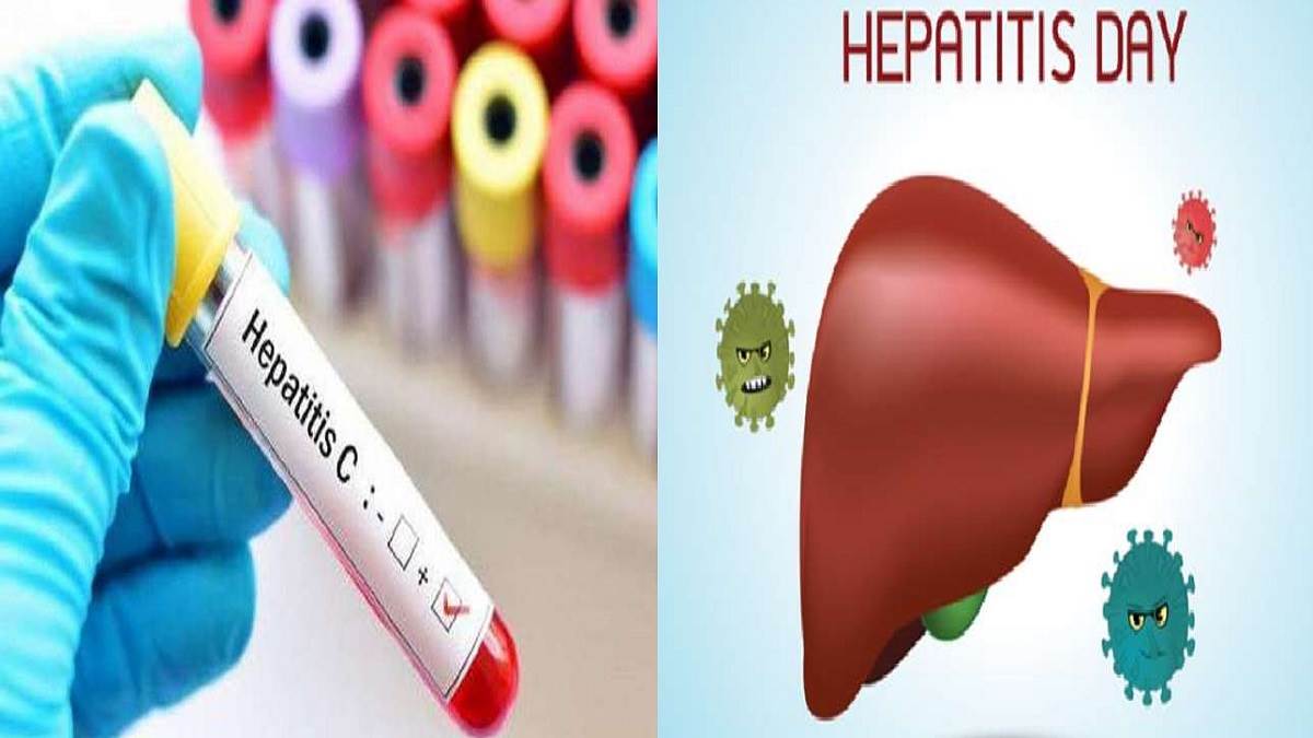 ncr hepatitis is increasing due to polluted water and food know the symptoms and treatment